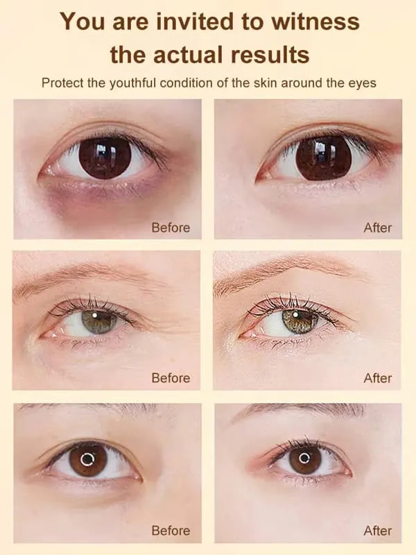 🔥HOT SALE🔥LAST DAY 48% OFF✨ Lutein Eye Essence Oil✨