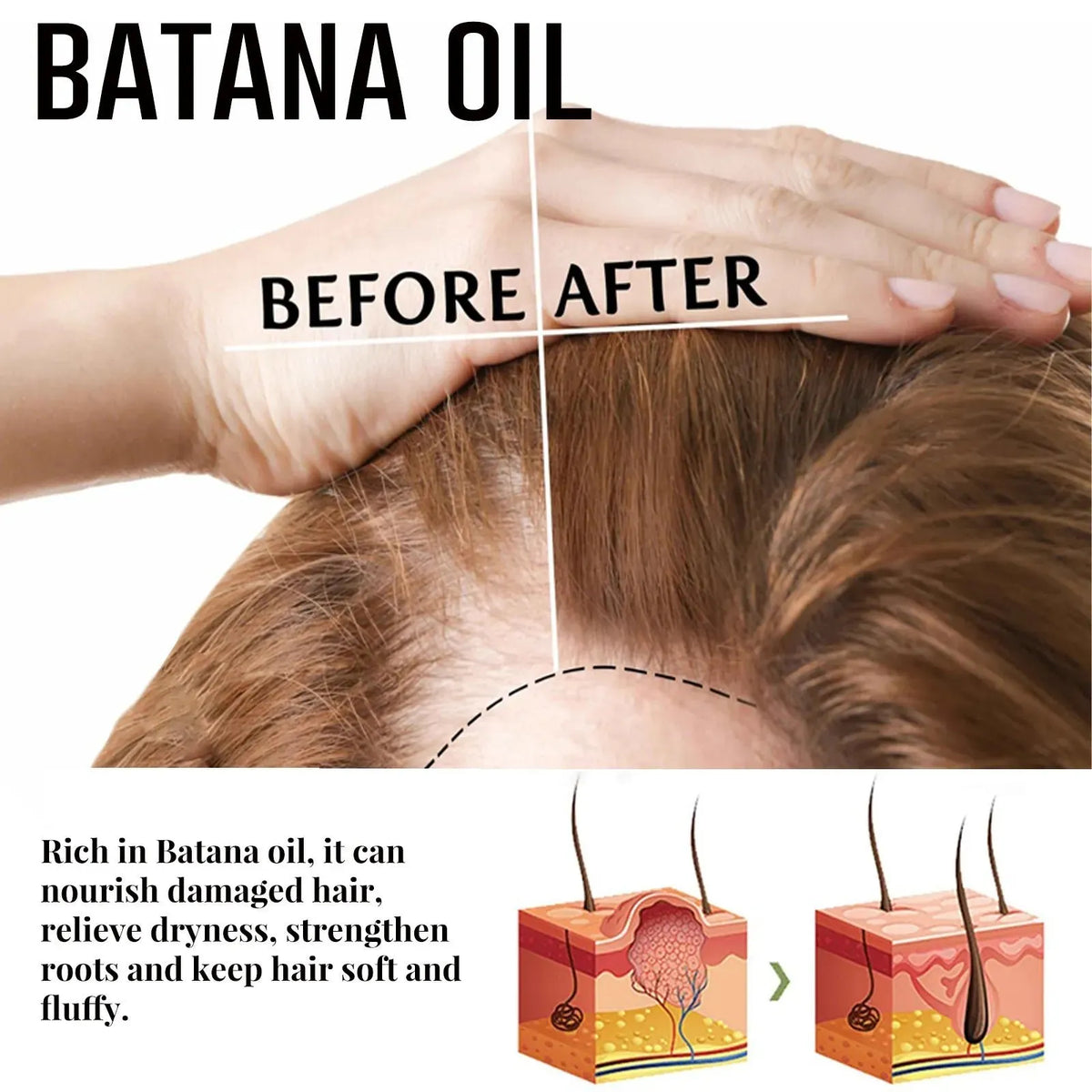 💯[Official Brand Store]- 🌿Natural Herbal Handcrafted Batana Oil Hair Growth Blend