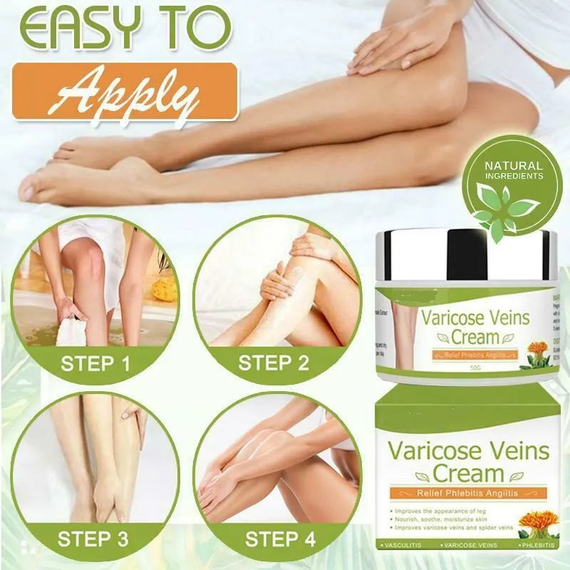 Varicose Veins Cream