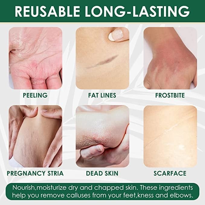 💥LAST DAY PROMOTION 70% OFF❣️Multifunctional Foot Repair Skin Moisturizing Cream