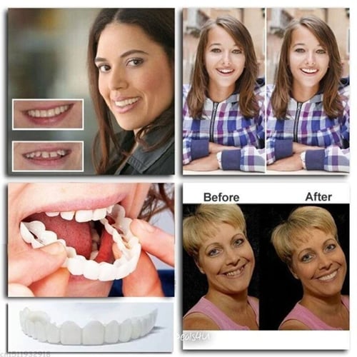 Official Brand Store - EeihoeTMAdjustable Snap-On Dentures