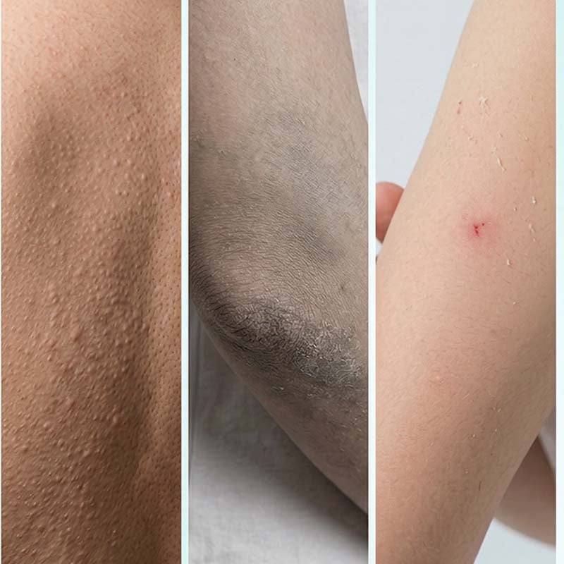 🔥 HOT SALE 🔥Moisturizing Exfoliating Body Wash Glove