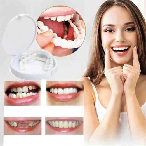 Official Brand Store - EeihoeTMAdjustable Snap-On Dentures