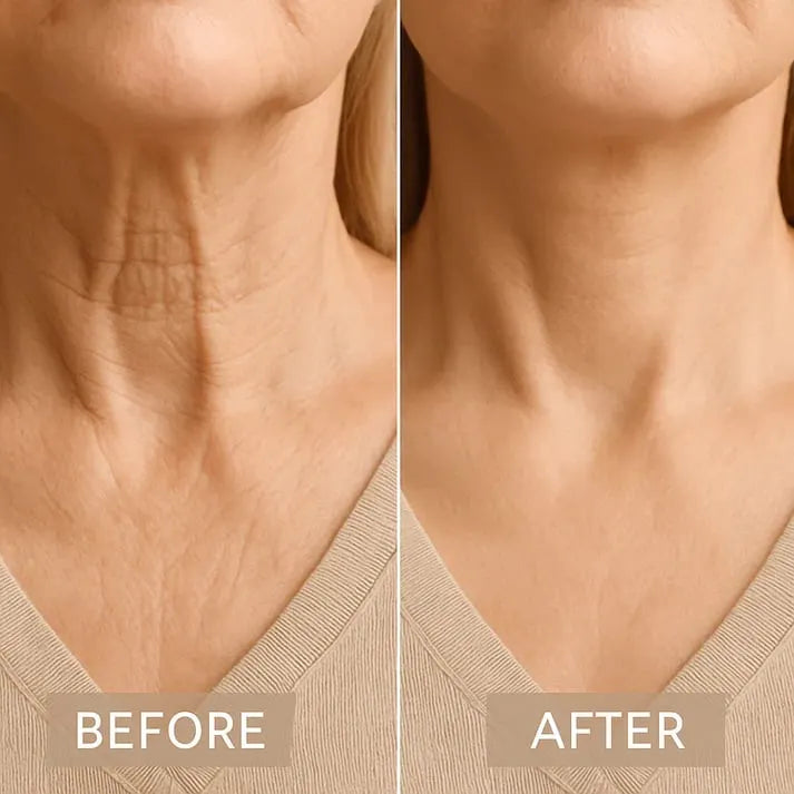 🔥HOT SALE🔥Instant Lift Neck Tape
