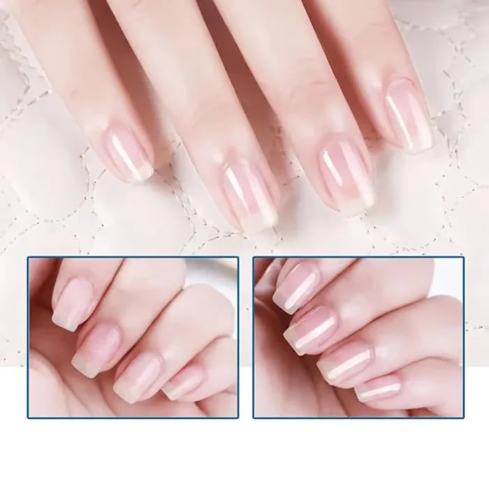 🔥HOT SALE🔥💖LAST DAY - BUY 1 GET 1 FREE!!💕 3 Days Nail Care Formula