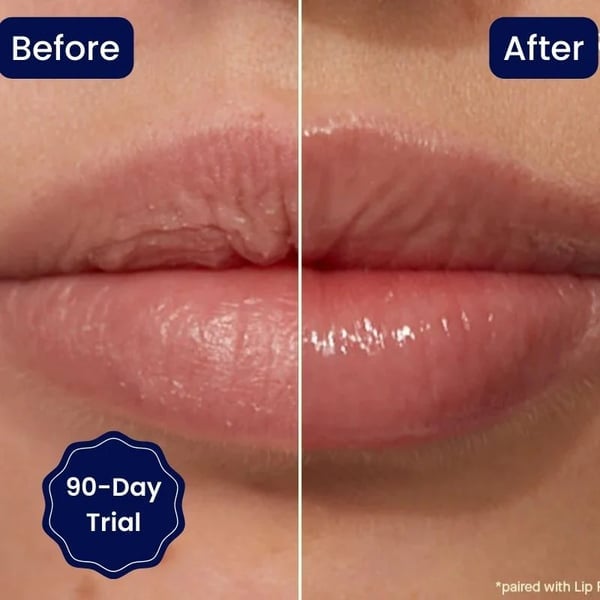 🔥BIG SALE - Vitamin E Lip Serum