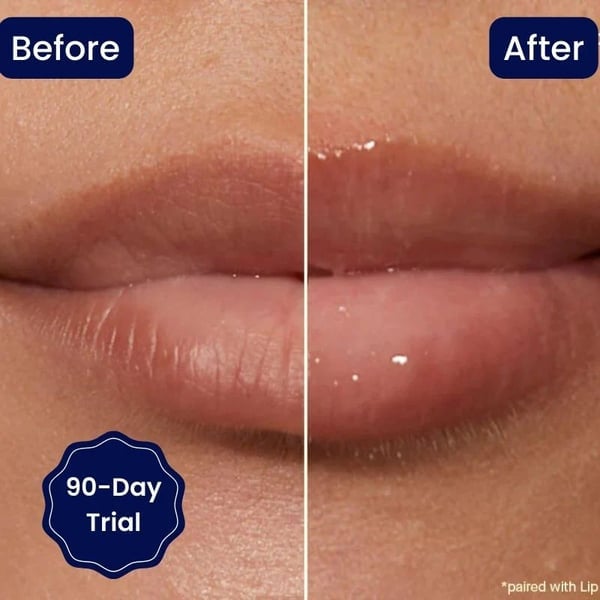 🔥BIG SALE - Vitamin E Lip Serum
